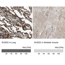 SUSD2 Antibody, Novus Biologicals 25 &mu;L; Unlabeled:Antibodies, Polyclonal